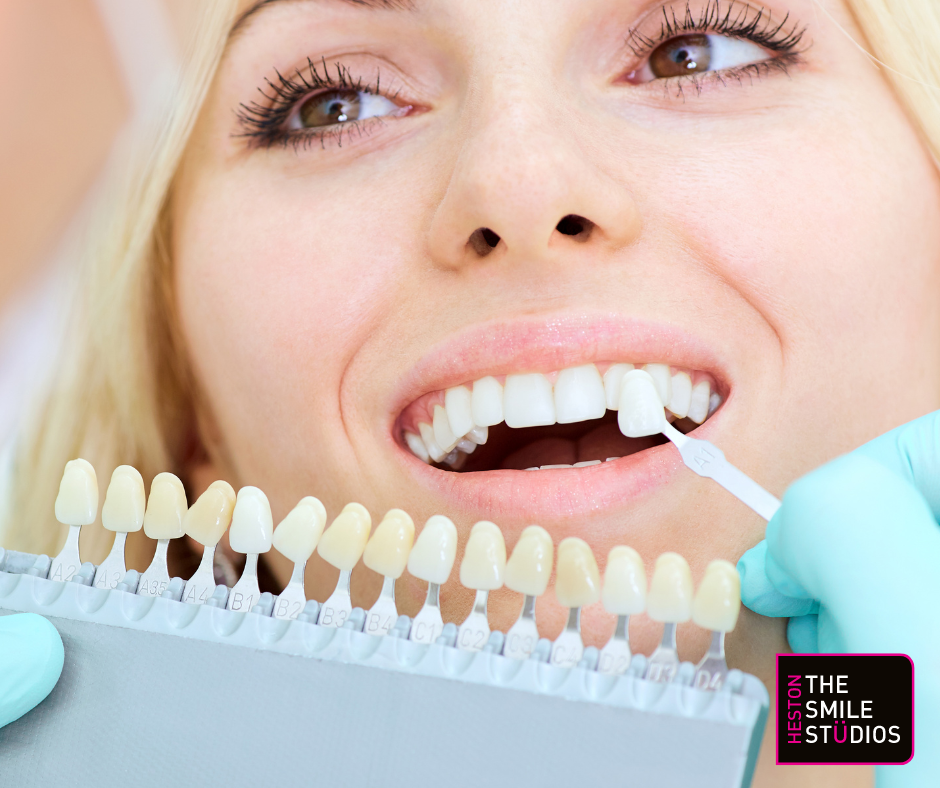 Close up of a young female adult with various dental restorations. The dentist is choosing a shade for her new tooth. 